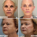 Bálsamo Multivitamínico de Cálcio | Cuidado Antienvelhecimento, Firmeza e Antirrugas