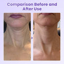 Adesivo antirrugas para pescoço com peptídeos