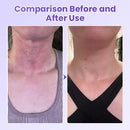 Adesivo antirrugas para pescoço com peptídeos