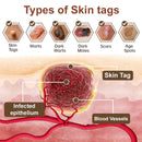 Black Rice Skin Repair Cream ⚕️ (Elimina verrugas e marcas, alivia psoríase, uniformiza a pele e reduz manchas)