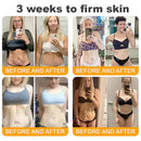 𝐁𝐞𝐞 𝐕𝐞𝐧𝐨𝐦 𝐀𝐥𝐥-𝐢𝐧-𝐎𝐧𝐞 𝐂𝐫𝐞𝐚𝐦