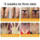 𝐁𝐞𝐞 𝐕𝐞𝐧𝐨𝐦 𝐀𝐥𝐥-𝐢𝐧-𝐎𝐧𝐞 𝐂𝐫𝐞𝐚𝐦