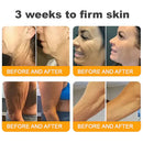 𝐁𝐞𝐞 𝐕𝐞𝐧𝐨𝐦 𝐀𝐥𝐥-𝐢𝐧-𝐎𝐧𝐞 𝐂𝐫𝐞𝐚𝐦